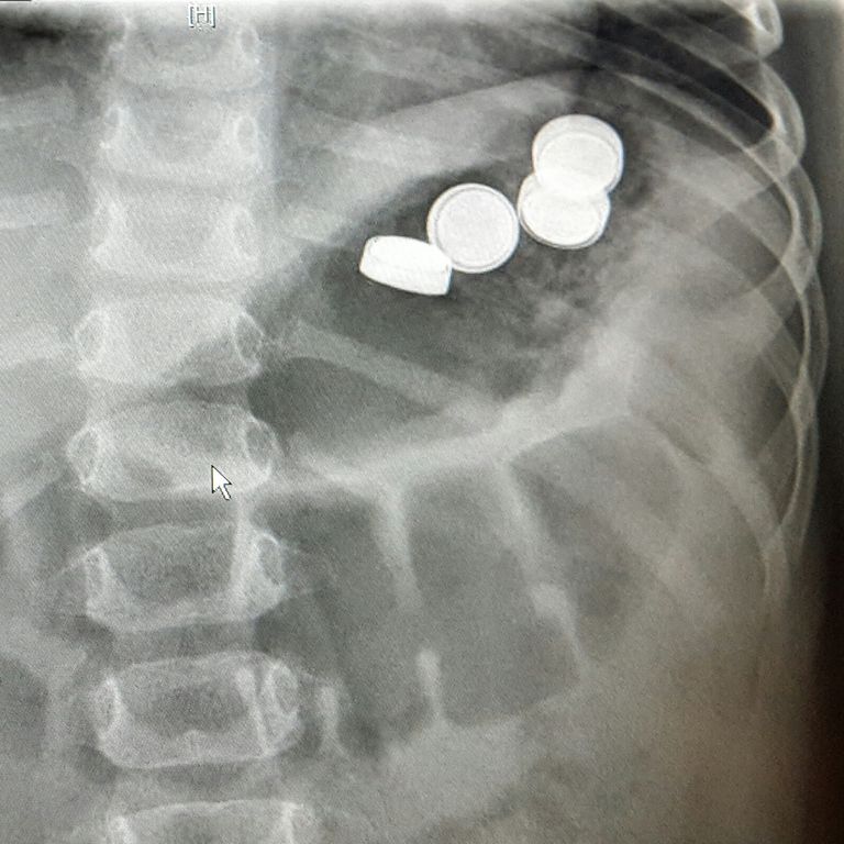 Patienteninformationen